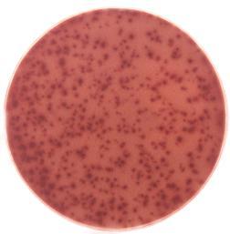 Detekční protilátky jsou pak vázané k anti-fitc-hrp na IFN-γ. Nakonec jsou po inkubaci s AEC vyvinuty barevné spoty. Buňky produkující IFN-γ dávají červené spoty. Obrázek 18.