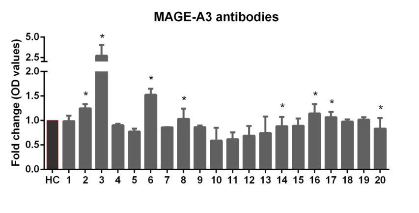 pacientů. V průběhu terapie jsme zaznamenali přítomnost IgG protilátek proti nádorovému antigenu PSA u 6 pacientů a přítomnost IgG protilátek proti MAGE-A3 u 8 pacientů (obr. 35). Obrázek 35.