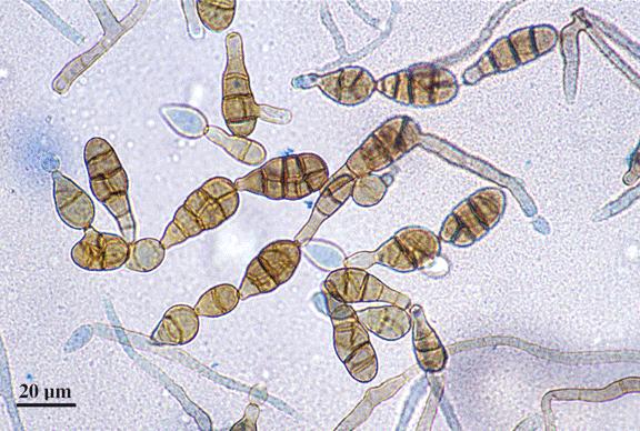 Alternaria sp. http://www.