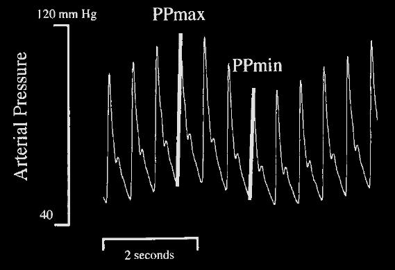 DYNAMICKÉ PARAMETRY (dynamické testy) SVV, PPV, SPV,.