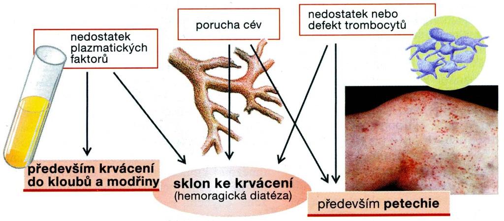 SRÁŢENÍ koagulační