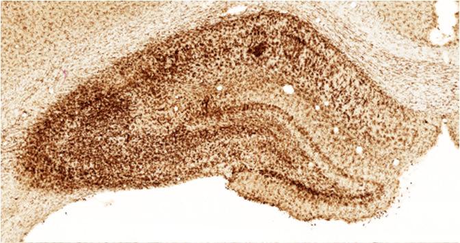 The infusion of NMDA into hippocampus induced significant reactive astrogliosis at all studied time points (Fig. 25 and 26).