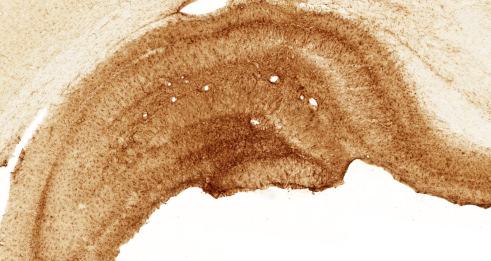 anti-gfap antibody taken from the ipsilateral dorsal