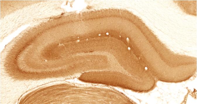NMDA lesion 1 dpi NMDA lesion 3 dpi NMDA lesion 7 dpi NMDA lesion 30 dpi SHAM lesion (PBS) Figure 38: Representative images of immunoperoxidase staining using anti-gaba A receptor γ2 subunit