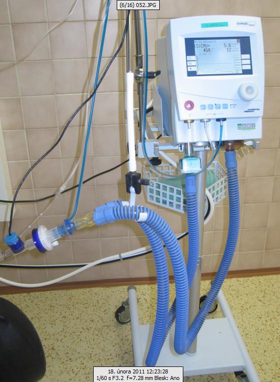 2. UMĚLÁ PLICNÍ VENTILACE (UPV) UPV je způsob dýchání, při němţ mechanický přístroj, tzv. ventilátor, částečně nebo plně zastupuje dýchací funkci klienta Obr.