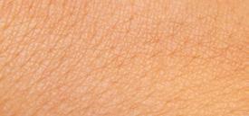 V použití Praktičtí lékaři Praktičtí lékaři v nizozemském Baarnu používají několik modelů Dino-Lite: Dermatoskop Dino-Lite dělá lepší a jasnější snímky kůže, než může poskytnout jakýkoli jiný