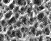 Pro Váš aktivní život Řídnutí kostí - osteoporóza Osteoporóza je metabolická kostní choroba, která se projevuje řídnutím kostní tkáně.