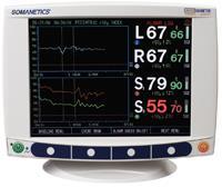 Autoregulace cerebrální perfuze Near infrared spectroscopy (NIRS)