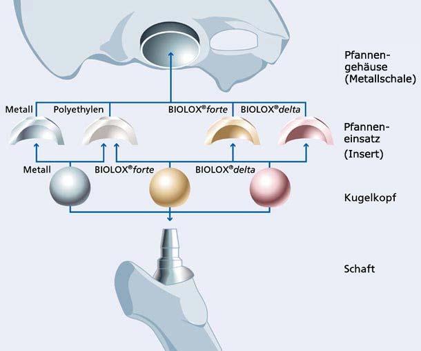 Materiály endoprotéz BIOLOX obchodní název