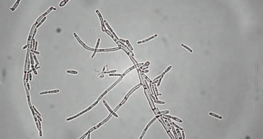 Na půdě s aktidionem rostly pouze dva kmeny divokých kvasinek rodu Saccharomyces, a z toho jeden pouze ve formě velmi drobných kolonií.