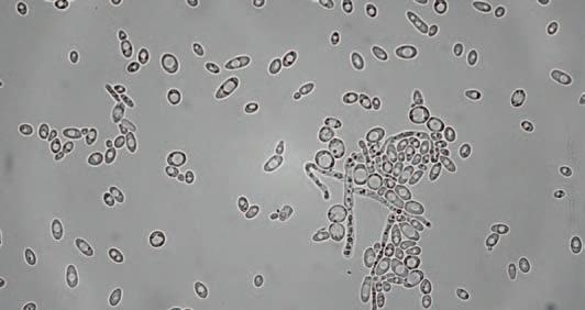 některé kmeny rodu Candida, Hanseniaspora, Kluyveromyces, Rhodotorula, Torulaspora aj. Z celkového počtu 87 kmenů cizích kvasinek na půdě s aktidionem rostlo pouze 19 (tj.