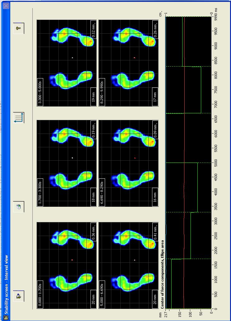 5.6 Intervalové zobrazení (Stability screen interval view) Po zmáčknutí tlačítka v horní liště základní obrazovky se zobrazí intervalová obrazovka.