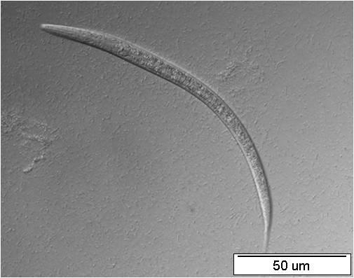 A B Obr.19: Larvální stádium L2 transgenní linie nhr-97::gfp PA C. elegans.