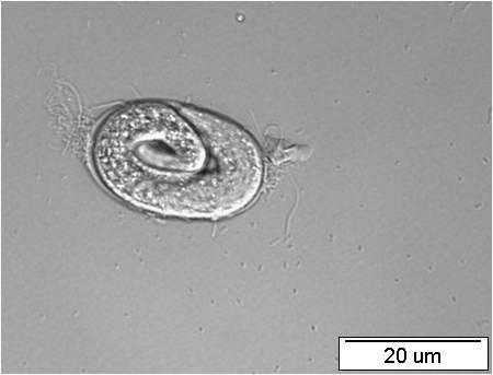 exprese u stádia L1) v hypodermis (Obr.25, 26).