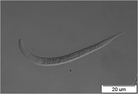 24: Embryo transgenní linie nhr-97::gfp P2A C. elegans ve stádiu trojího ohnutí.