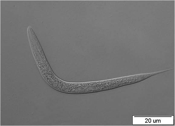 A B Obr.26: Larvální stádium L2 transgenní linie nhr-97::gfp P2A C. elegans.