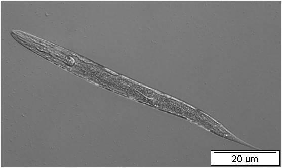 A B Obr.27: Larvální stádium L3 transgenní linie nhr-97::gfp P2A C. elegans.