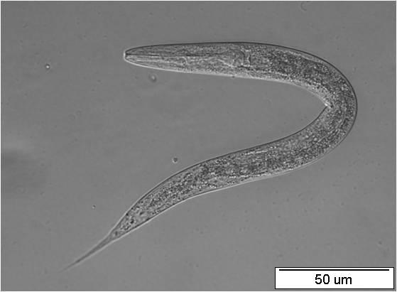 A B Obr.28: Larvální stádium L4 transgenní linie nhr-97::gfp P2A C. elegans.