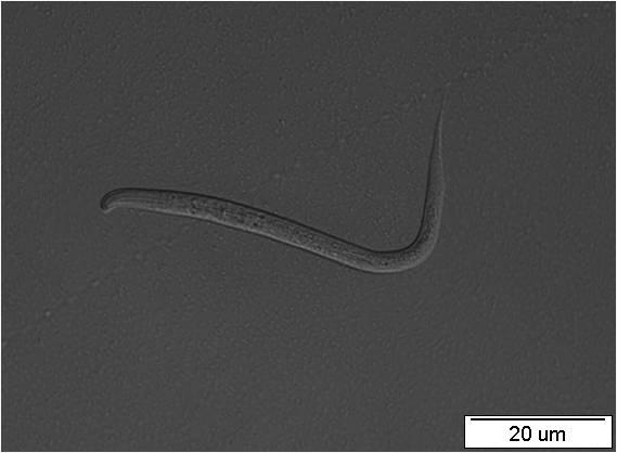 A B Obr.34: Larvální stádium L1 transgenní linie nhr-97::gfp P2B C. elegans.