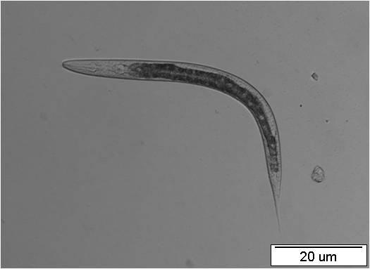 A B Obr.35: Larvální stádium L2 transgenní linie nhr-97::gfp P2B C. elegans.