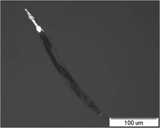A B Obr.36: Larvální stádium L3 transgenní linie nhr-97::gfp P2B C. elegans.