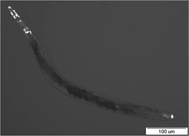 Exprese nhr-97::gfp byla detekována v hltanu (šipky uprostřed) a v neuronech okolo korpusu hltanu (šipky vlevo) a v análním svěrači (šipky vpravo). A B Obr.