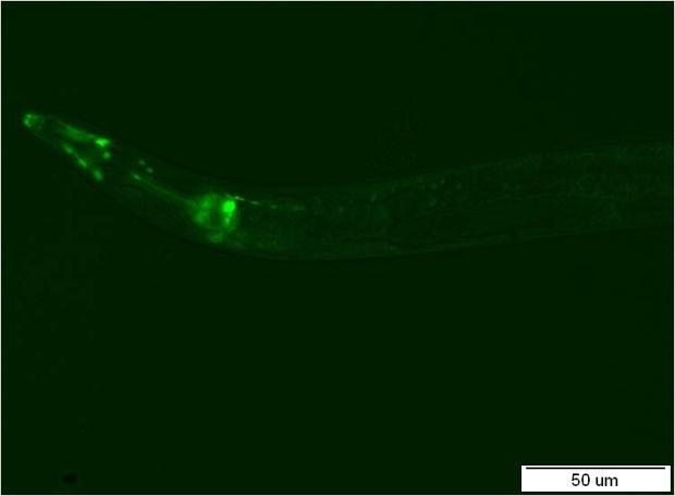 A B C Obr.38: Detailní pohledy na hlavu (A, B) a ocásek (C) transgenní linie nhr-97::gfp P2B C. elegans.
