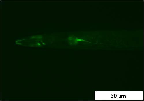 elegans (A) v oblasti zůžení hltanu (A, šipka uprostřed), v druhé zaoblené části hltanu (A, šipka vpravo) a v neuronech okolo korpusu hltanu (A, šipka vlevo).