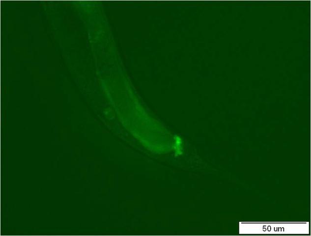 3 Stanovení exprese mrna nhr-97 v jednotlivých vývojových stádiích C. elegans pomocí kvantitativní polymerázové řetězové reakce (qpcr) 4.3.1.