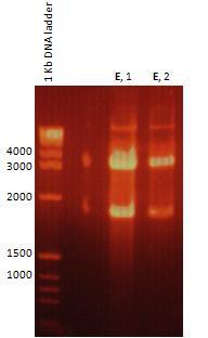 stádiích C. elegans metodou kvantitativní PCR. A B C Obr.39: Vzorky nukleových kyselin po reakci s DNasou.