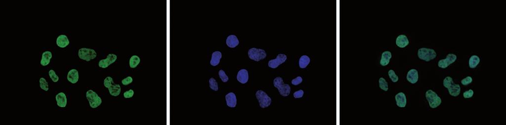 Figure 6. Immunofluorescence using the Diagenode antibody directed against H3K9/14ac HeLa cells were stained with the Diagenode antibody against H3K9/14ac (Cat. No. C15410200) and with DAPI.