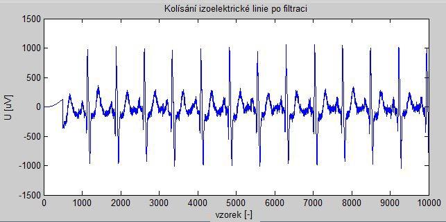 Obr. 1.9: Kolísání izoelektrické linie po filtraci na převodu signálu na frekvenční spektrum obr. 1.10. Následně dojde k vynulování spektra na frekvencích do 1,5 Hz obr. 1.11.