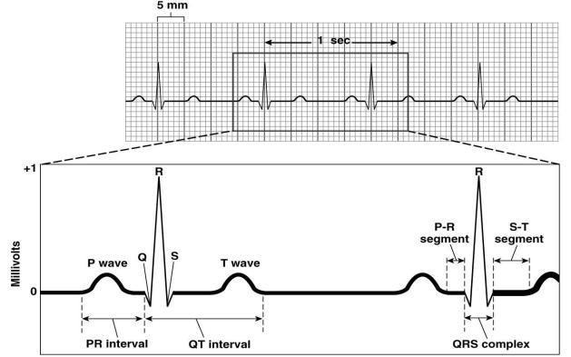 4 Vlastnosti signálu EKG 4. Signál EKG Z EKG signálu je moţné detekovat tyto události (obr.4.): P vlna (ačátek, vrchol, konec), Q vlna (ačátek a vrchol), R vlna (vrchol), S vlna (vrchol, konec), T vlna (ačátek, vrchol, konec).