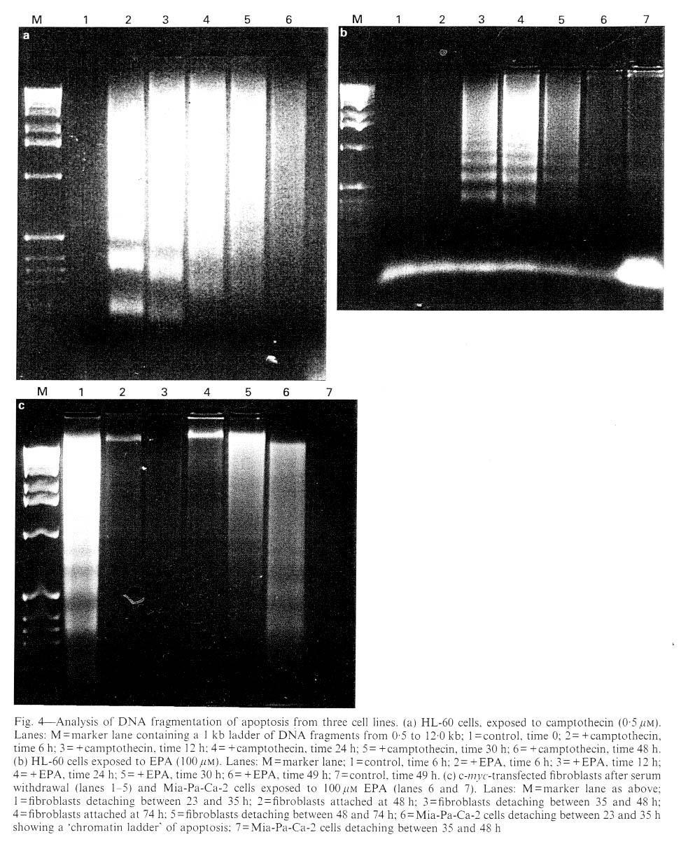 Analýza fragmentace DNA během apoptózy Tvorba žebříčku ladder po expozici leukemické linie HL-60 kampotecinem (a) nebo