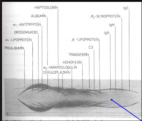 Imunoelektroforegram normálního lidského séra při použití polyspecifického antiséra až 35 precipitačních obloučků (každý oblouček = 1 protein), které mají