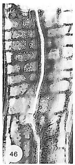 26. Středně velké: 7 10 µm 27. Velké: 10 µm Ztenčenina s rouchem 29.