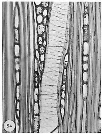 Spirální ztluštěniny lokální ztloustlá místa buněčné stěny ve formě spirály na vnitřní ploše cévních článků 36. Spirální ztluštěniny přítomny ve dřevě 37.