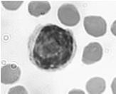 LYMFOCYT Lymfocyt je buňka podle své funkce různě dlouho žijící Morfologicky se jedná o menší kulatou buňku s jádrem vyplňujícím většinu buňky a menším množstvím bazicky se barvící cytoplasmy Podle