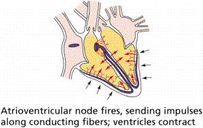 (pacemaker) - Atrio-ventrikulární