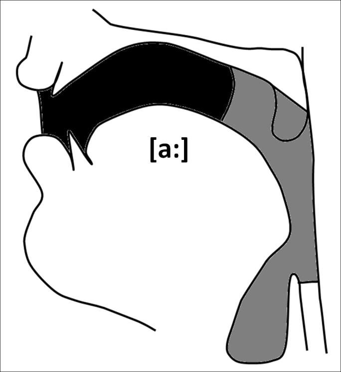 3.3.5.1 Vokál [a:] Při fonaci vokálu *a:+ je dutina ústní celkem volná, ústa jsou otevřena nejvíce a jazyk se patra vůbec nedotkne (Hála, a další, 1962). Podoba ústního otvoru je zobrazena na obr. 15.