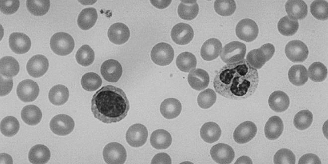 23. Měňavkovitého pohybu jsou schopné buňky, které jsou zároveň schopné fagocytózy. A) K čemu buňky fagocytózu využívají?