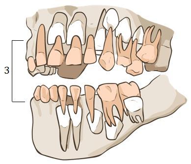 měsícem života; kolem 6. roku je postupně nahrazen zubem stálým: 9b) Přiřaďte k číslům na obrázcích 7, 8 termíny z cvičení 9a.