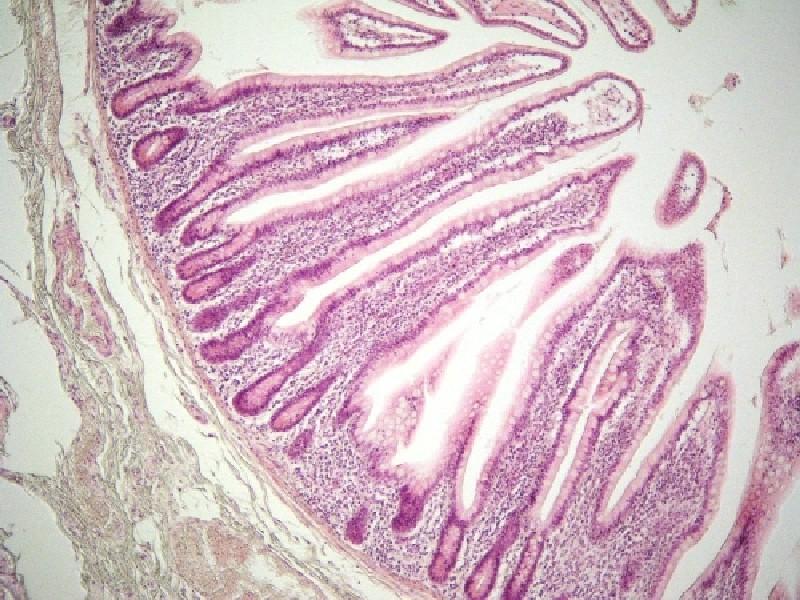 Sliznice tenkého střeva Epitel jednovrstevný cylindrický, 6 typů b.: Enterocyty - 90 % buněk, štěpení a resorpce živin, transport IgA - jádro v dolní třetině, nad ním většina organel - mezibuněčné.