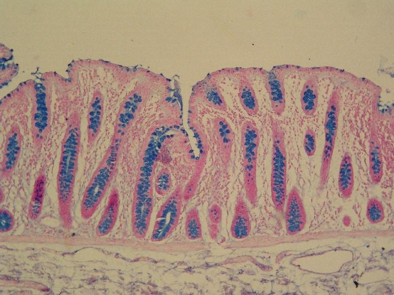 Sliznice tlustého střeva Epitel jednovrstevný cylindrický délka 1,5 m, šířka 5-8 cm Sliznice nemá klky, jen nízké řasy Mucinózní žlázky (pohárkové buňky)=> tvorba