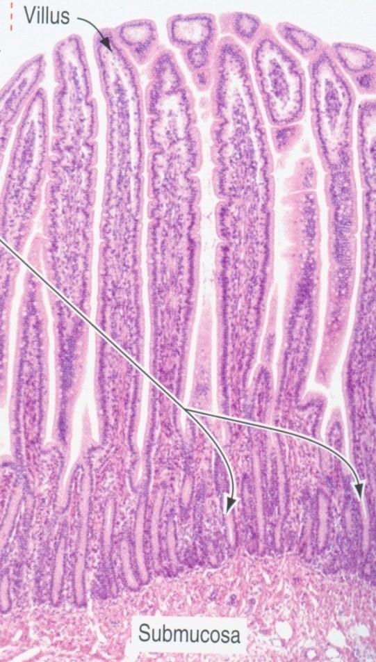 Obnova epitelu střevní sliznice klk Lüberkühnovy krypty Klky - apex - apoptóza enterocytů na vrcholu klků střední úsek - fukční enterocyty, pohárk.