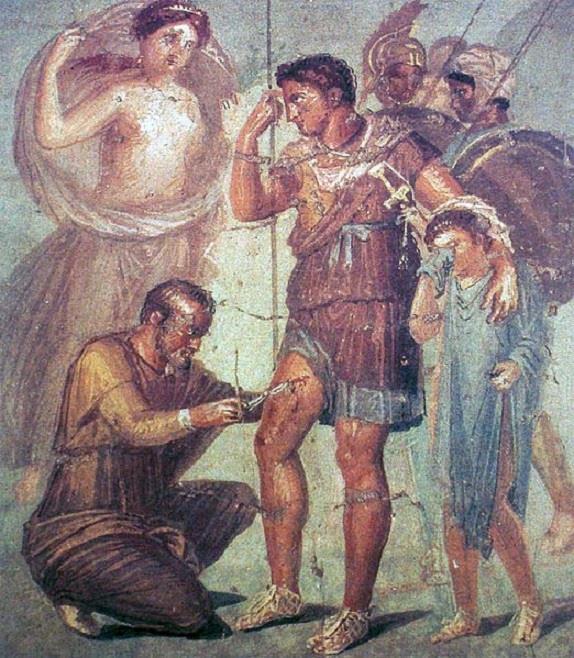23 Aeneas je ošetřován japyxem, jenž mu z rány v noze vytahuje hrot šípu, po boku mu stojí znepokojená matka Venuše a plačící syn Ascanius