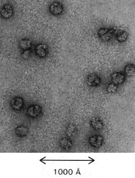 a/ b/ Obr. 7.13: a: Elektronová mikrofotografie eukaryotických ribozómů. b: Trojrozměrný model ribozómu E. coli. Ribozóm E.