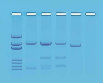 NÁVOD Výsledky a analýza pokusu Relativní pozice fragmentů DNA jsou zobrazeny v idealizovaném schématu, ale nejsou ukázány v měřítku.