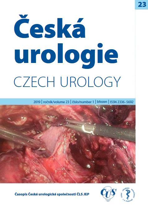 Časopis Česká urologie 1/2019 a 2/2019 V první polovině tohoto roku vyšla další dvě čísla časopisu Česká urologie. Archiv časopisu a aktuální číslo České urologie naleznete ZDE.