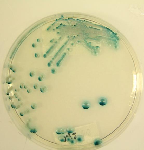 2.5. Charakteristika testovaných kmenů 2.5.1. Candida albicans Je nejvíce patogenním druhem kandid.